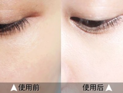 日本腾素效果如何?实测30天揭秘真相与避坑诀窍优质