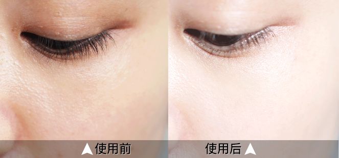 日本腾素效果如何？实测30天揭秘真相与避坑诀窍